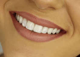 Healthy Tips from Pharmasave: Cosmetic Dentistry