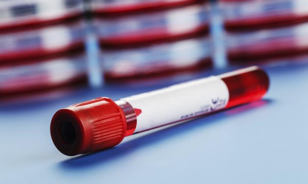 Prostate Cancer DNA Test Uses Small Blood Sample, Predicts Response to Drug