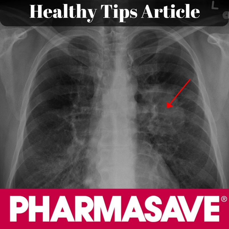 Healthy Hints from Pharmasave: Lung Cancer