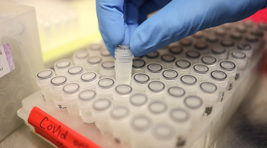 Safely Saving COVID-19 Samples for Research